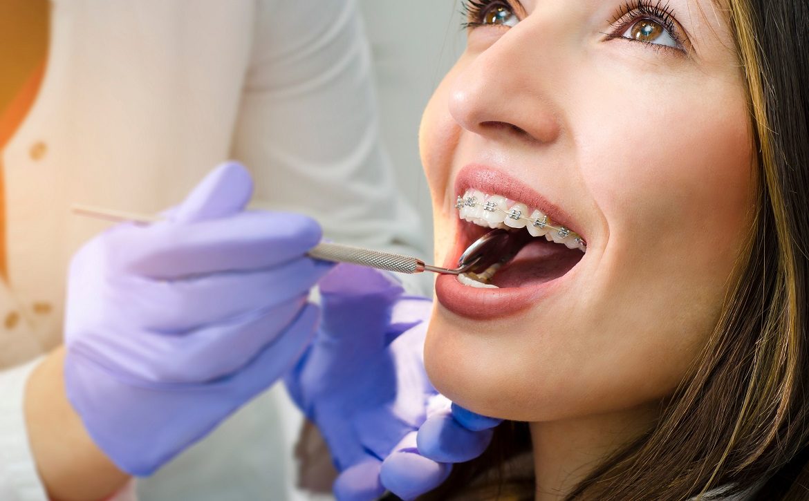 Closeup of beautiful girl on dental braces check up
