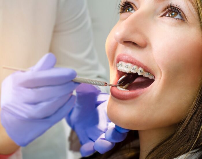Closeup of beautiful girl on dental braces check up